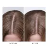 Восстанавливающее средство для жирной кожи головы Moroccanoil Oil-No-More Scalp Treatment 45 мл, изображение 4