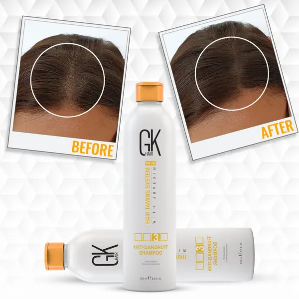 Шампунь GKhair Anti-Dandruff Shampoo 250 мл против перхоти, изображение 3